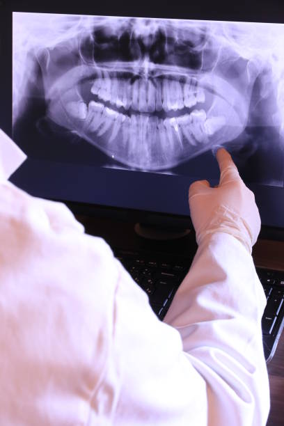 Best Emergency TMJ Treatment in South Bloomfield, OH