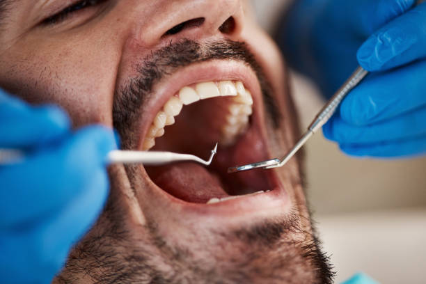 Best Weekend Emergency Dentist in South Bloomfield, OH
