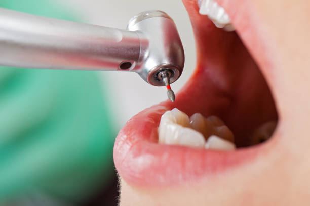 Best Same-Day Emergency Dental Services in South Bloomfield, OH